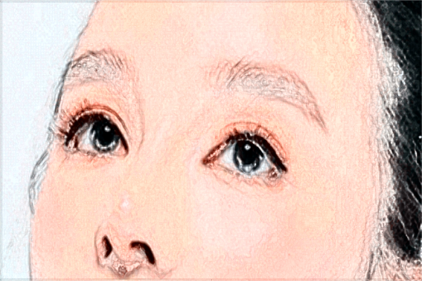 抽脂消除腫眼泡價(jià)格表一覽_腫眼泡抽脂多久恢復(fù)?