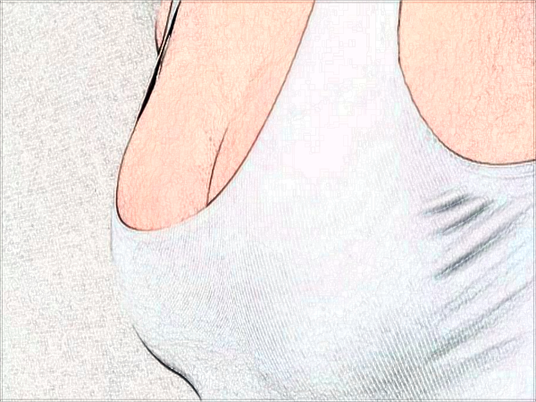 常州玻尿酸隆胸醫(yī)院排名_(十月公布)玻尿酸隆胸價目表