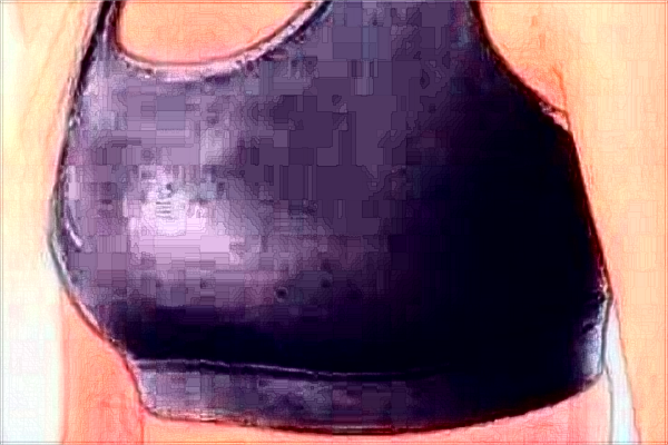 去副乳價(jià)目表公布_去副乳會(huì)留疤嗎