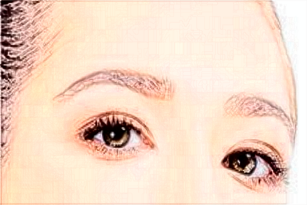 割雙眼皮需要多少錢一次?割雙眼皮需要恢復多長時間?