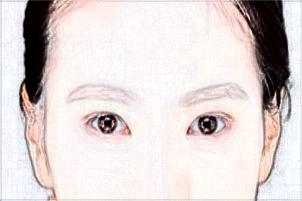 2024定點(diǎn)雙眼皮價目表公布_定點(diǎn)雙眼皮多久恢復(fù)自然