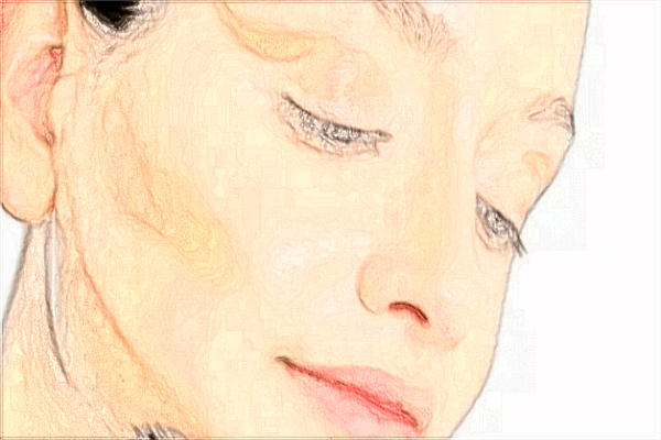 2024義烏鷹鉤鼻矯正價格表(價目表)怎么樣