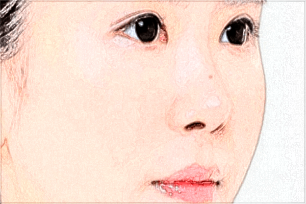 2024重慶聯(lián)合麗格脂肪填充怎么樣【附手術(shù)案例】