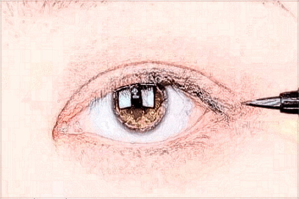 北京同仁醫(yī)院做眼袋好不好?去眼袋可以管多久