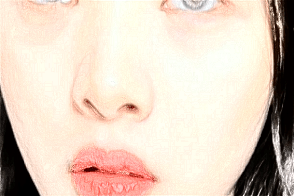 上海伊萊美隆鼻醫(yī)生哪個(gè)好【隆鼻案例】