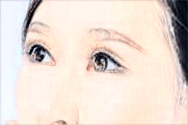 2024煙臺洛神做眼袋哪位醫(yī)生技術(shù)好_【附眼袋案例】