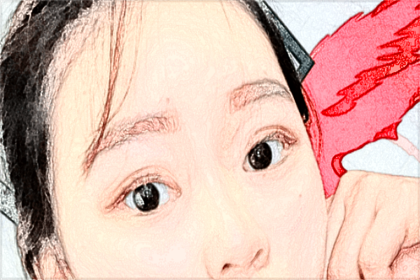 潮州哪里可以做雙眼皮?做的好嗎?