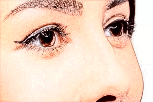 2024北京沃爾整形醫(yī)院鼻子做的好不好_附醫(yī)生名單