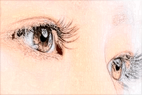 激光去眼袋的價目表_激光去眼袋的危害和效果