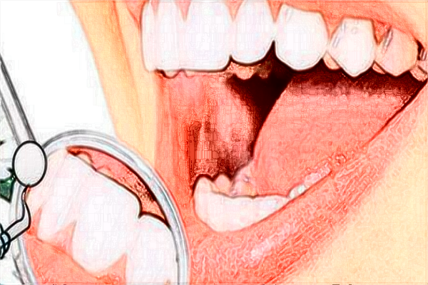 2024鄭大一附院正畸價(jià)格表(價(jià)目表)一覽
