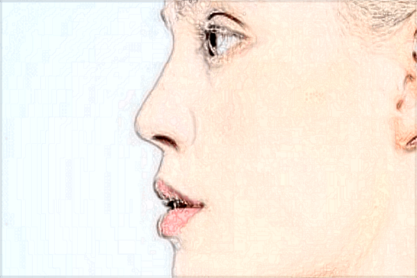 2024北京協(xié)和醫(yī)院隆鼻大概多少錢(qián)_附醫(yī)生名單