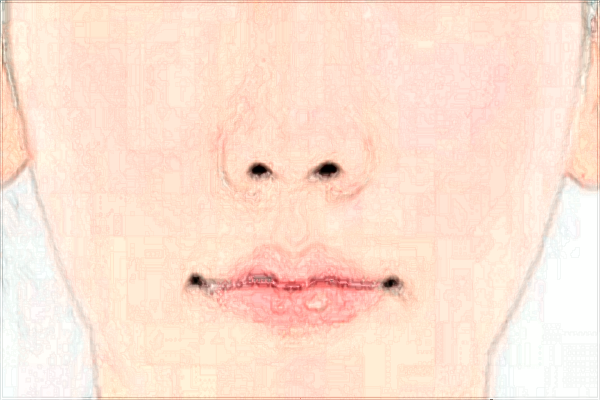 2024北京協(xié)和醫(yī)院隆鼻大概多少錢(qián)_附醫(yī)生名單