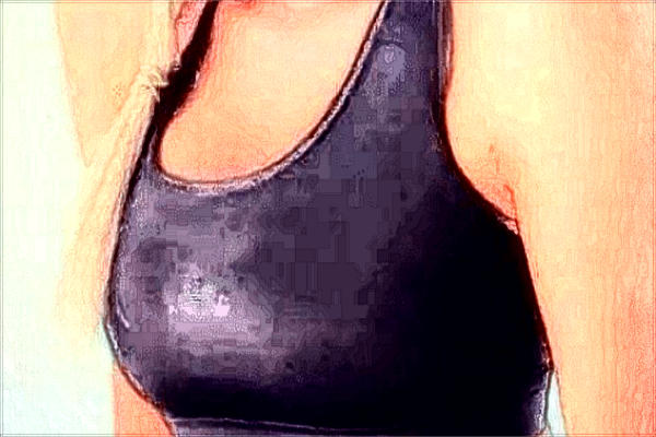 上海伊萊美哪個(gè)醫(yī)生隆胸好_附隆胸手術(shù)案例