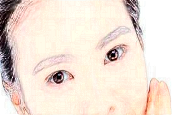 上海伊萊美做雙眼皮怎么樣_醫(yī)生推薦