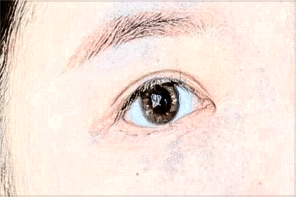 2024吉林大學第二醫(yī)院做上眼瞼提肌術多少錢