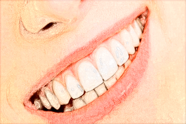 2024沈陽二院補牙價目表_補牙后需要做牙套嗎