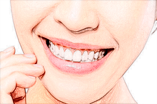 2024北京麗都種植牙價格表_種植牙的后遺癥有哪些