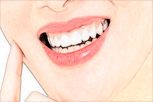 2024北京麗都種植牙價格表_種植牙的后遺癥有哪些