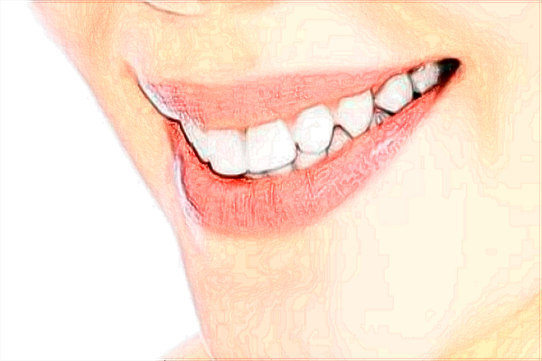 北京天壇醫(yī)院補(bǔ)牙價(jià)目表(價(jià)格表)怎么樣