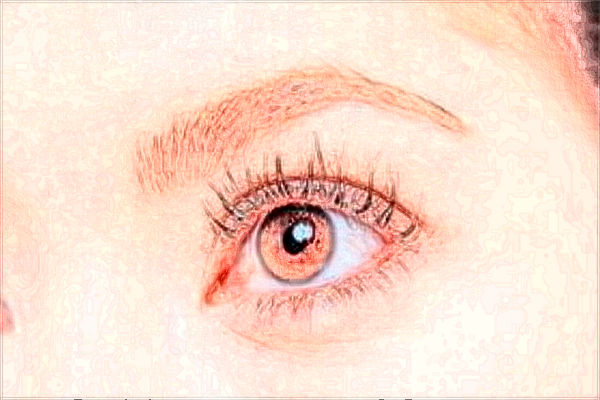 北京藝美做雙眼皮價(jià)目表(價(jià)格表)怎么樣