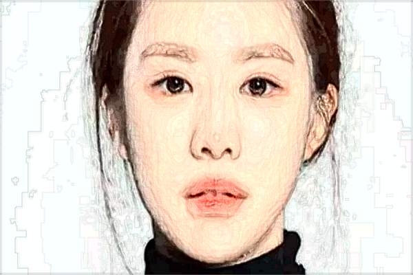 北京藝美自體脂肪豐臥蠶怎么樣【附自體脂肪豐臥蠶案例】