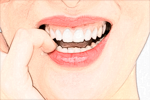 2024牙齒貼面的價(jià)格是多少?牙齒貼面能保持多久