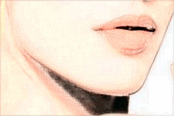 浙江醫(yī)院正頜價格怎么樣?正頜手術(shù)風險大嗎