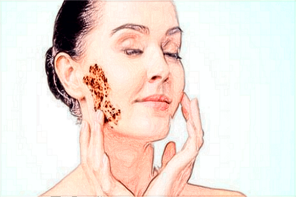 2024鑲牙價(jià)格費(fèi)用?鑲牙要多久時(shí)間