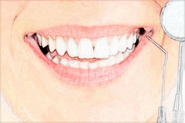 牙齒發(fā)黃怎么去除變白?2024洗牙多少錢