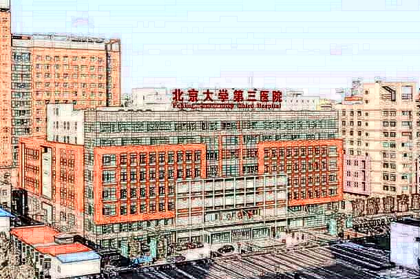北京大學(xué)第三醫(yī)院吸脂醫(yī)生收費價格2024