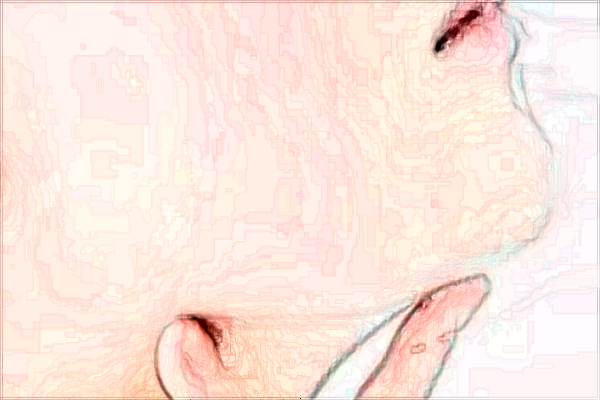 北京潤美玉之光去雙下巴哪個醫(yī)生好_怎么樣