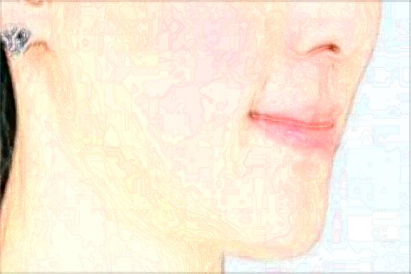 北京潤美玉之光去雙下巴哪個醫(yī)生好_怎么樣