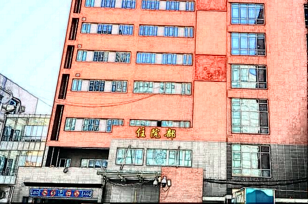 北京二院去眼袋怎么樣?2024去眼袋收費價格