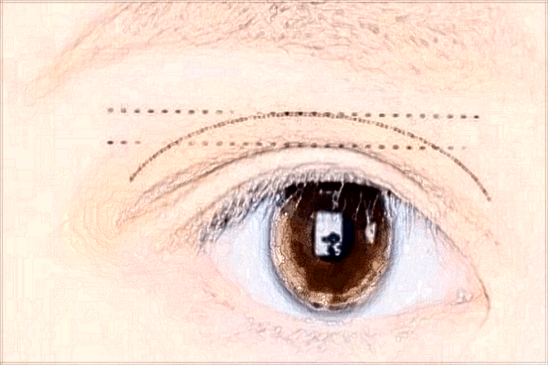 北京二院2024做雙眼皮價格?做雙眼皮哪個醫(yī)生好