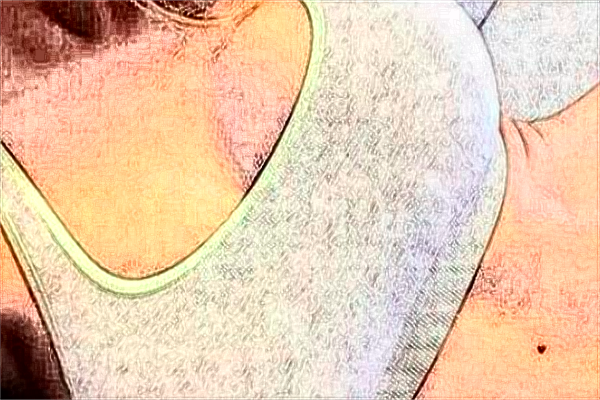 貴陽(yáng)中醫(yī)學(xué)院二附院脂肪填充怎么樣_醫(yī)生技術(shù)怎么樣