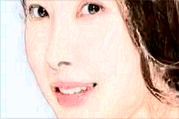 玻尿酸豐面頰能維持多久?玻尿酸豐面頰是*的嗎?