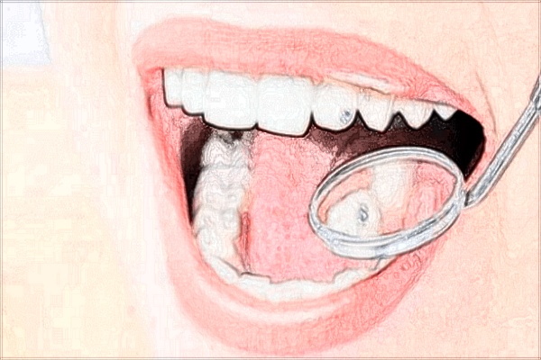 北京大學口腔醫(yī)院美白牙齒怎么樣_哪位醫(yī)生做的比較好