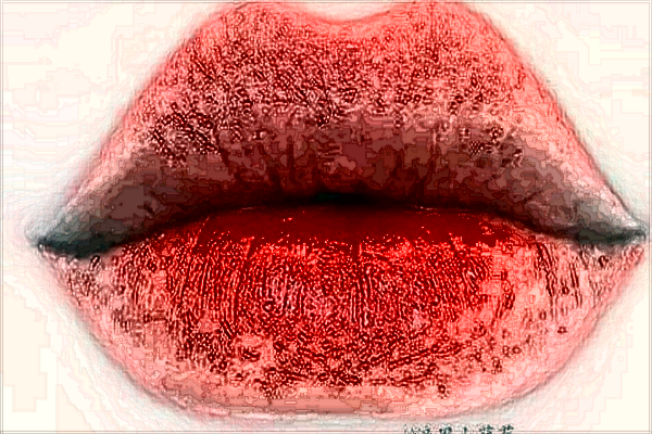 2024交大二院玻尿酸豐唇怎么樣【玻尿酸豐唇案例】