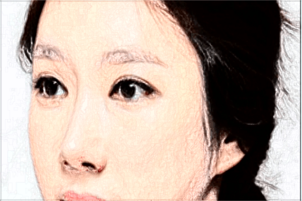 淮安二院激光美容科祛斑好不好?祛斑激光費(fèi)用多少