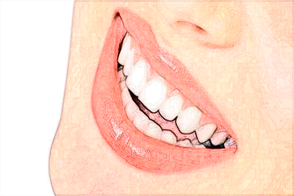 廣州華美牙科怎么樣_附醫(yī)生名單推薦