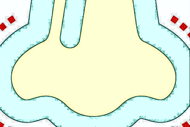 膨體隆鼻會變細變窄嗎?膨體隆鼻會回縮多少呢?