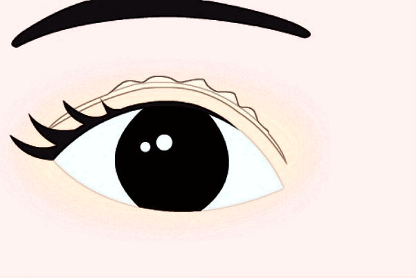 2024做臥蠶收費價格多少_西安二院做臥蠶怎么樣