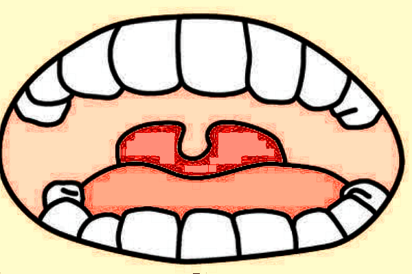 2024河北省口腔醫(yī)院牙齒矯正價格表_做的怎么樣