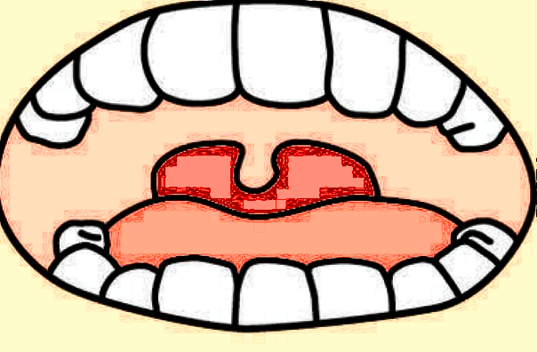 廈門(mén)大學(xué)附屬中山醫(yī)院矯正牙齒怎么樣?矯正牙齒多少錢(qián)