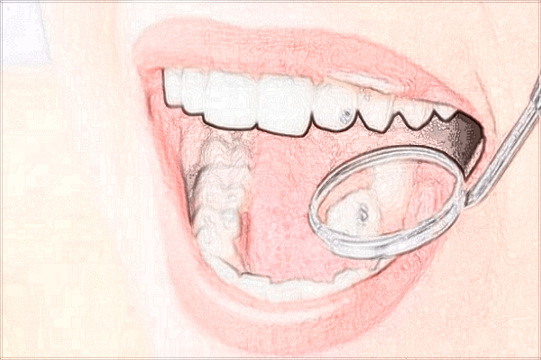 2024四川省人民醫(yī)院口腔科補牙多少錢_價格表+案例