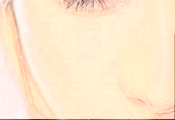 上海華山醫(yī)院脂肪填充需要多少費(fèi)用_做的好的醫(yī)生有哪些