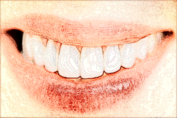 2024四川省人民醫(yī)院烤瓷牙怎么收費(fèi)_醫(yī)生推薦