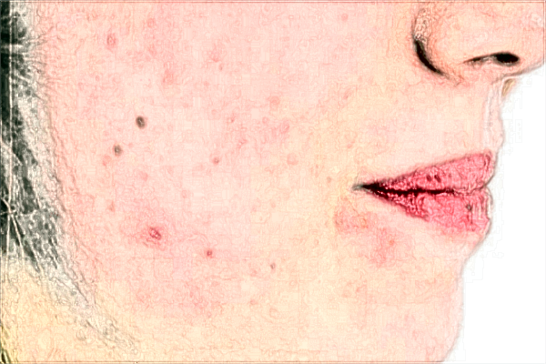 2024威海市立二院自體脂肪填充面部價格怎么樣