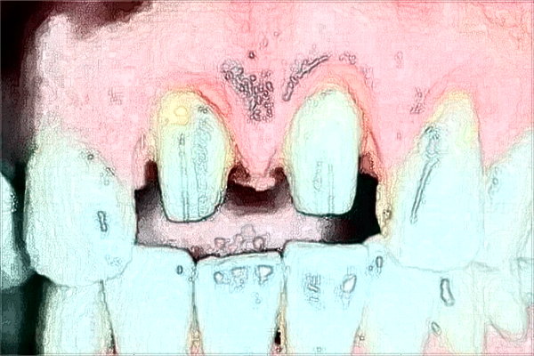 福州市第二醫(yī)院牙科怎么樣?2024牙齒矯正價格一覽