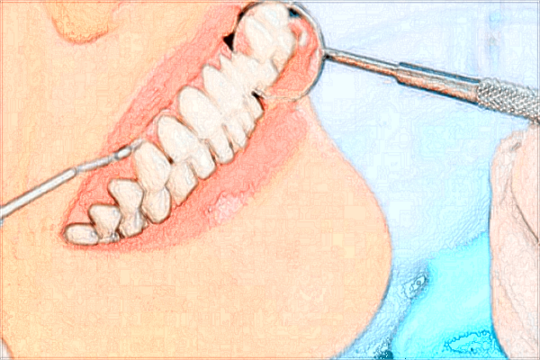 2024福建中醫(yī)學(xué)院附屬人民醫(yī)院口腔科較好的醫(yī)生收費價格